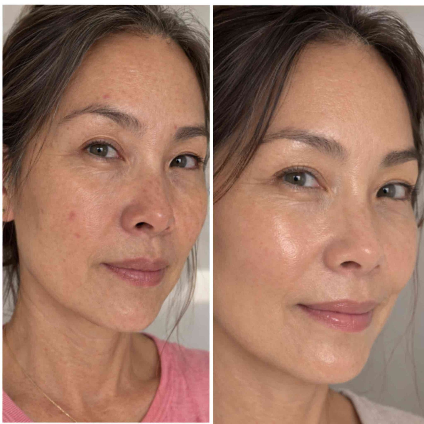AUREN™ PDRN Hydrogel Mask