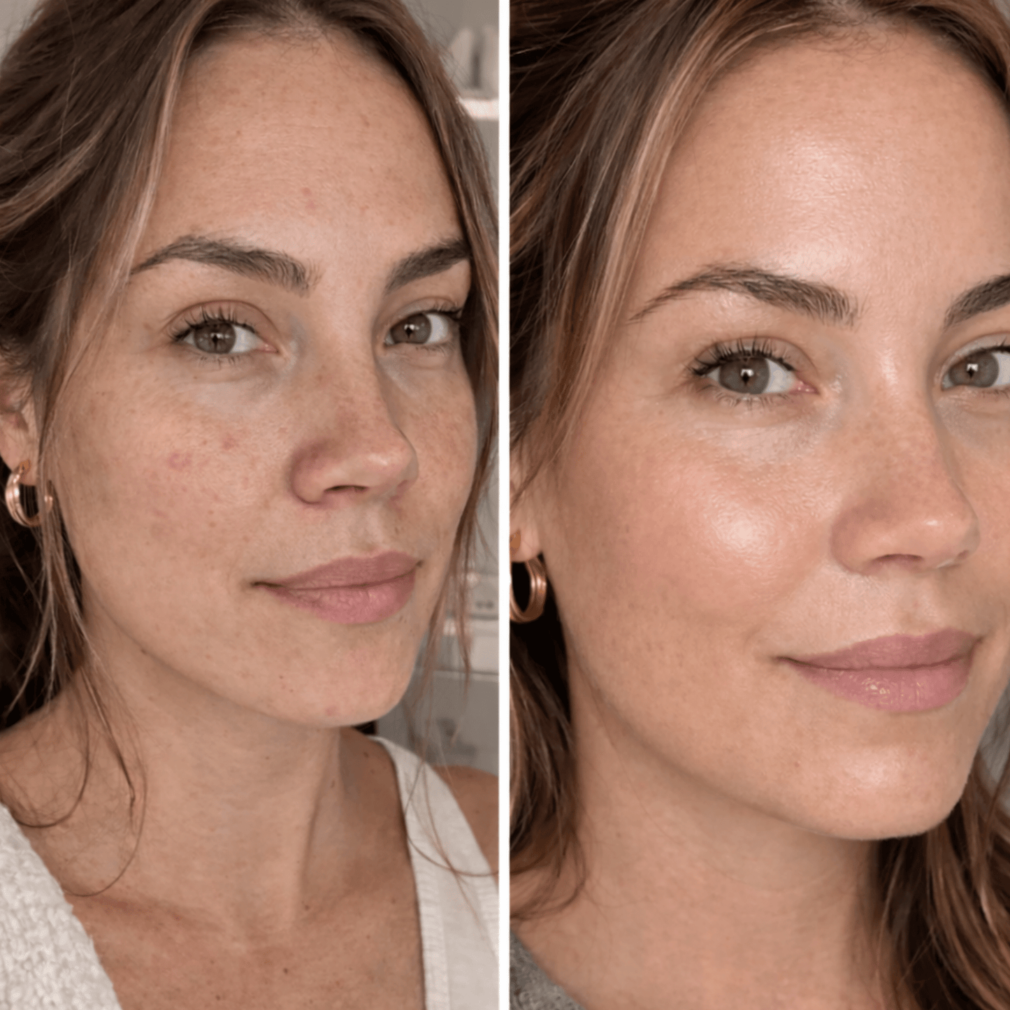 PDRN Hydrogel Mask(4 Pack) by Koa Luxe