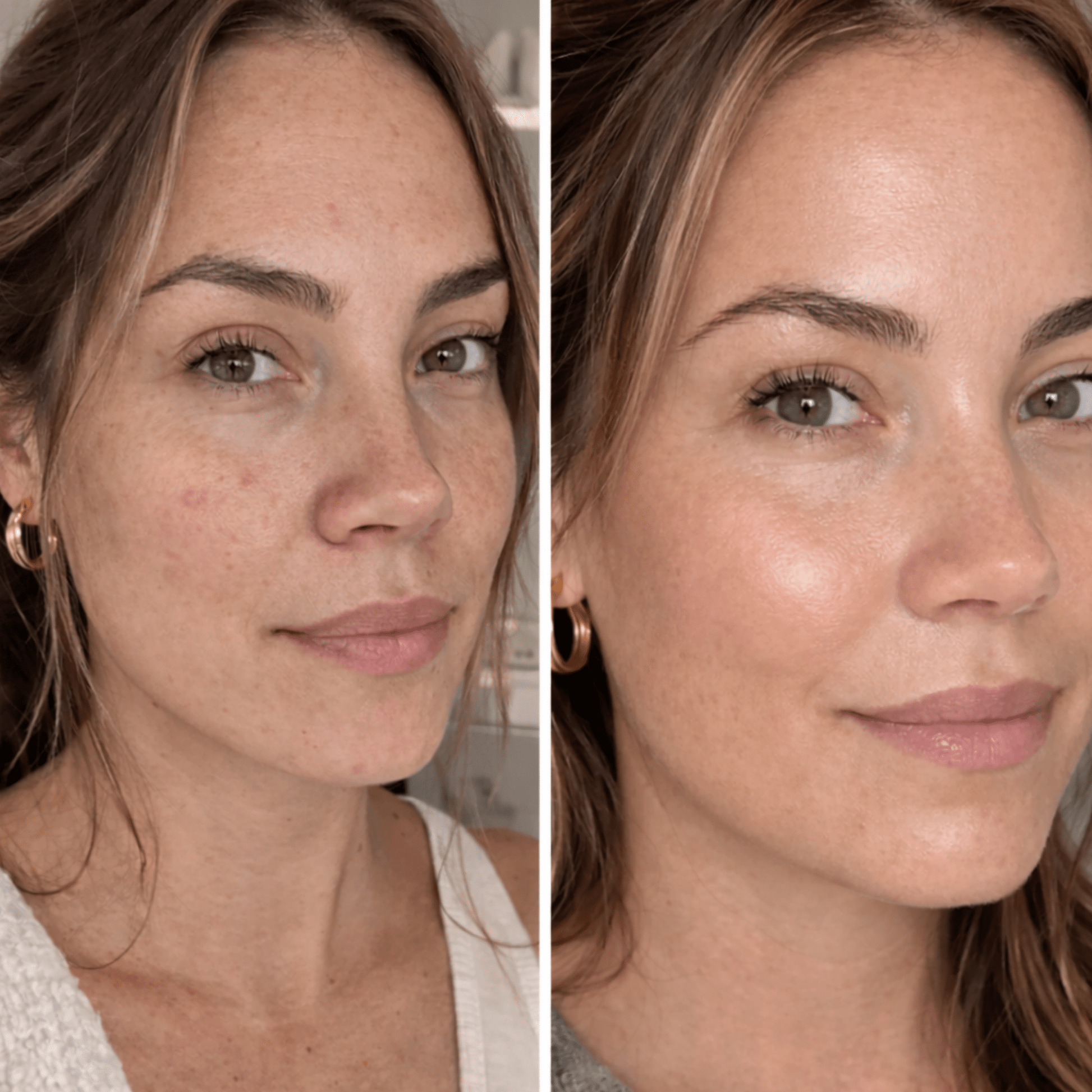 PDRN Hydrogel Mask(4 Pack) by Koa Luxe