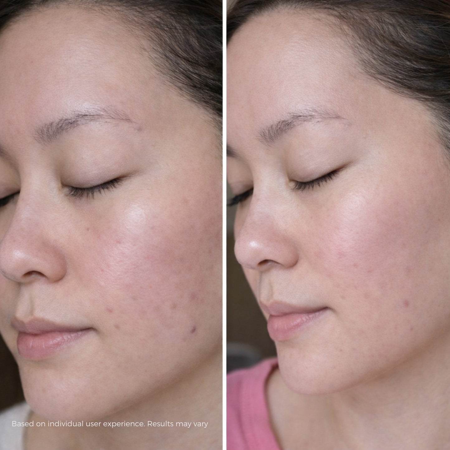 Koaluxe™ PDRN Collagen Capsule Cream