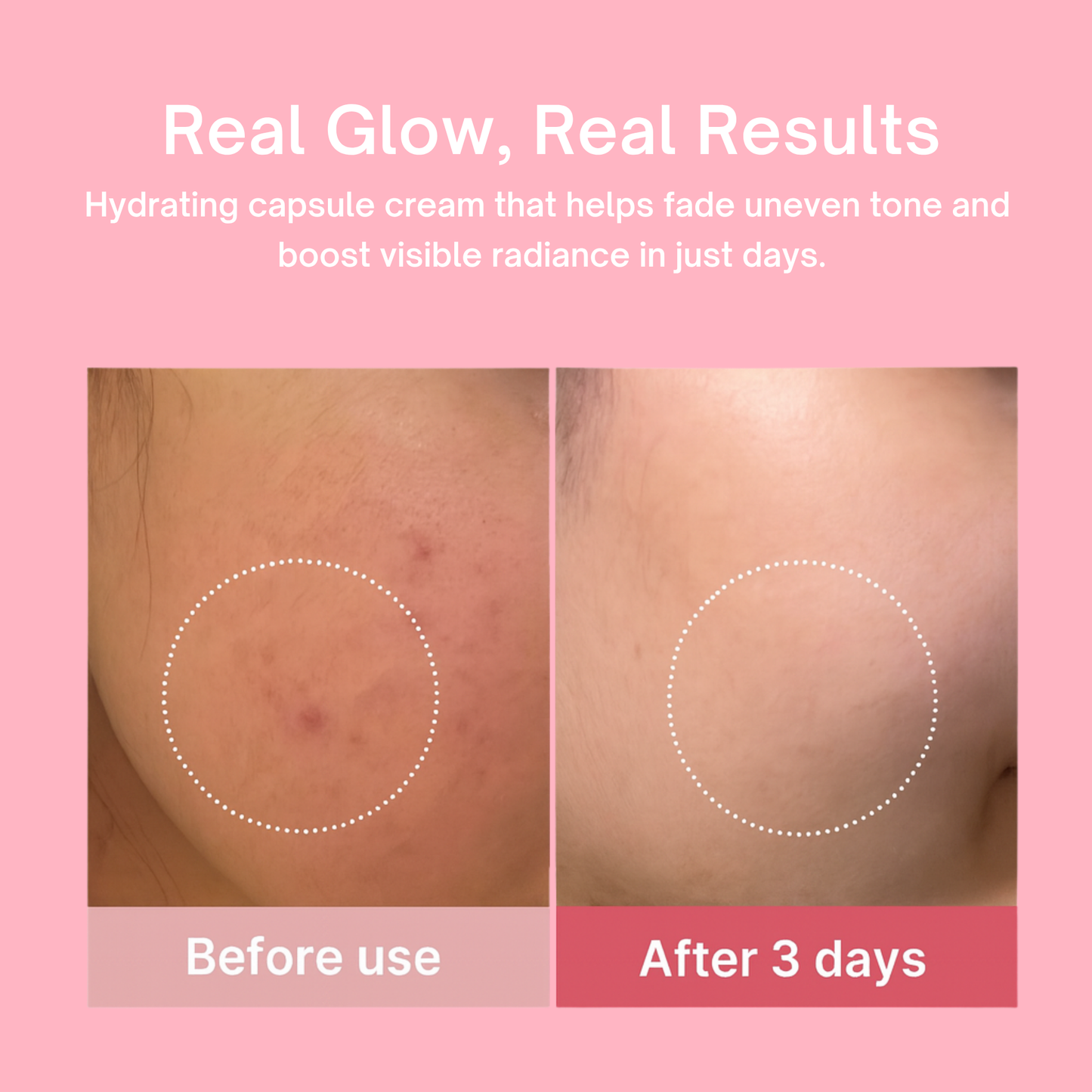 Koaluxe™ Collagen PDRN Capsule Cream