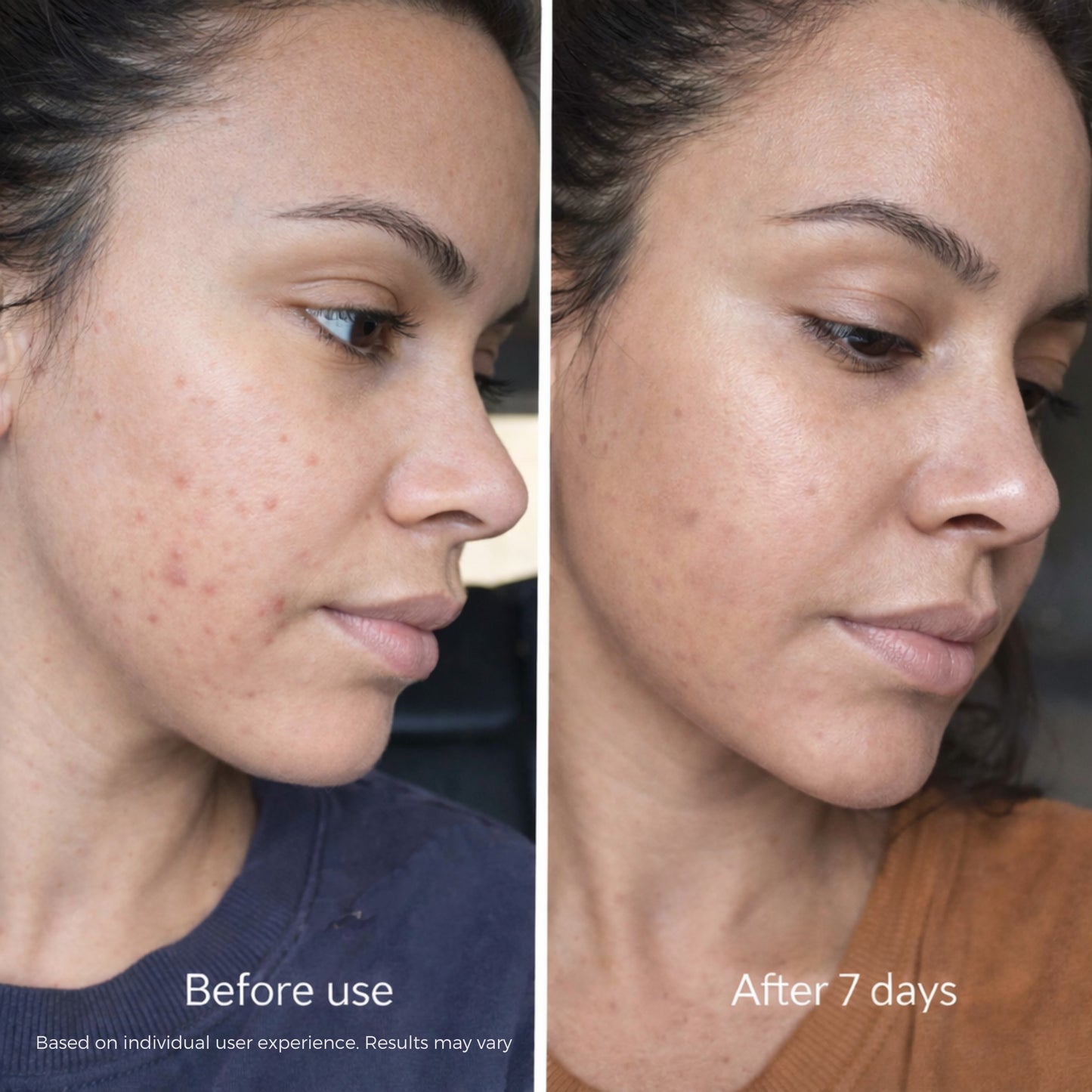 Koaluxe™ PDRN Collagen Capsule Cream