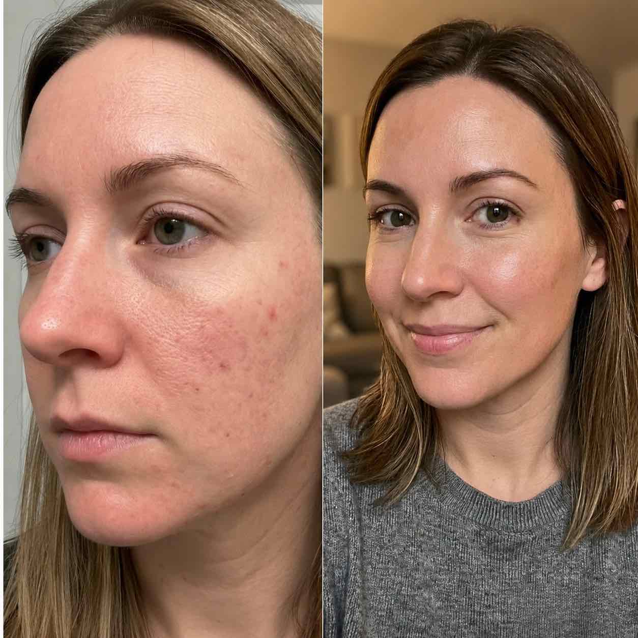 SOLA™ PDRN Exosome Serum