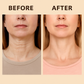 Peptivia™ Contour Roll- On Cream