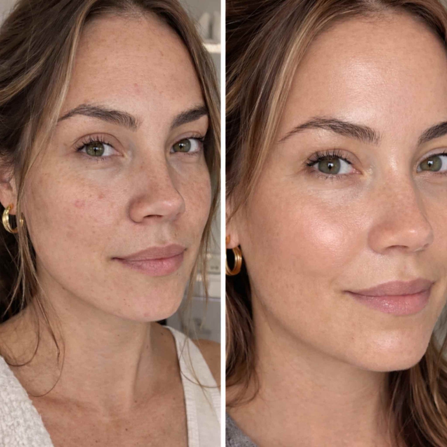 AUREN™ PDRN Hydrogel Mask