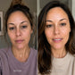 Koaluxe™ PDRN Collagen Capsule Cream